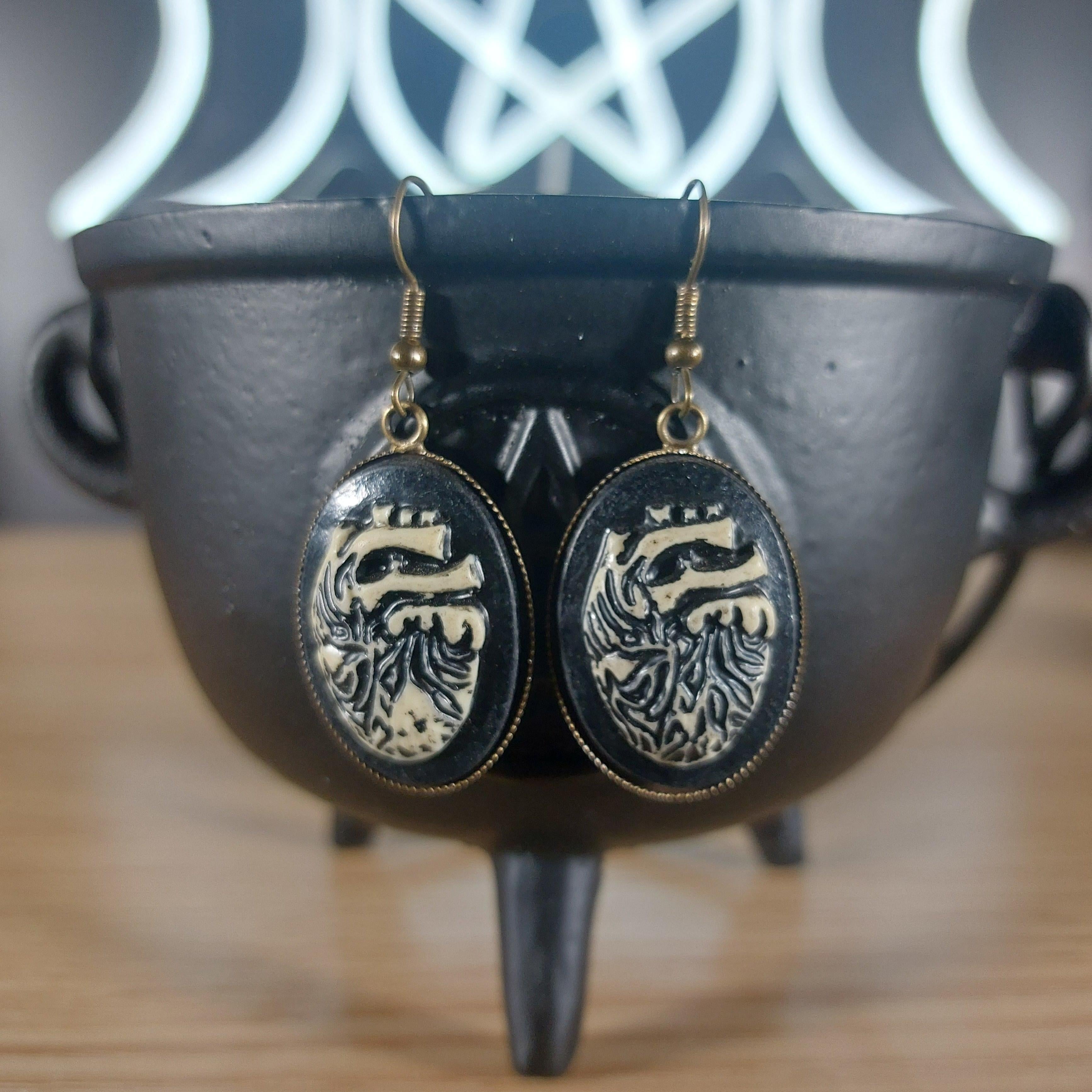 Antique bronze tone dangle earrings with black oval cameos featuring white anatomical hearts.